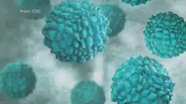 Medical experts warn of rise in norovirus -- an easily spread stomach bug